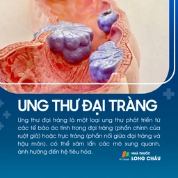 Ung thư đại tràng 1