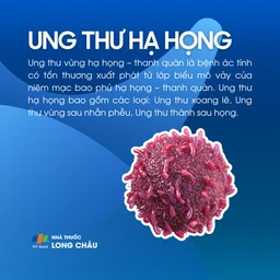 Ung thư hạ họng 1
