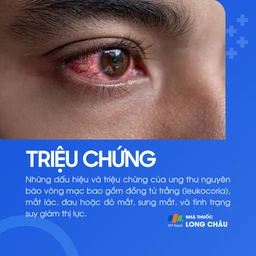 Ung thư nguyên bào võng mạc 2