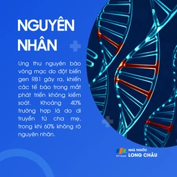 Ung thư nguyên bào võng mạc 3