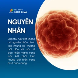 Ung thư ruột kết 3