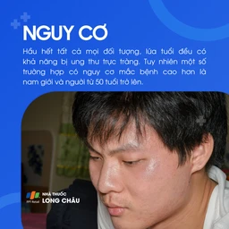 Ung thư trực tràng 4