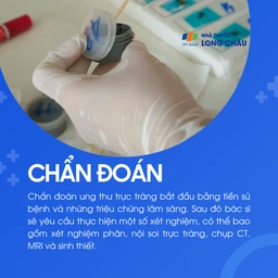 Ung thư trực tràng 5