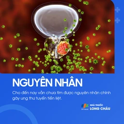 Ung thư tuyến tiền liệt 3