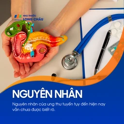Ung thư tuyến tụy 3