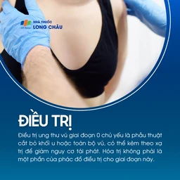 Ung thư vú giai đoạn 0 6