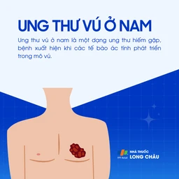 Ung thư vú ở nam 1