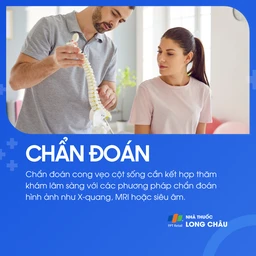 Vẹo cột sống 5