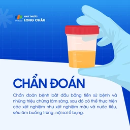 Viêm buồng trứng 5