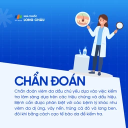 Viêm da đầu 5