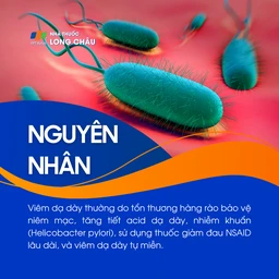 Viêm dạ dày 3