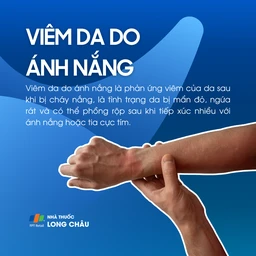 Viêm da do ánh nắng 1