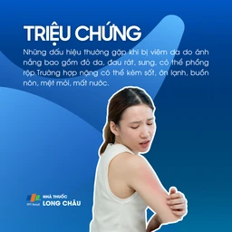 Viêm da do ánh nắng 2