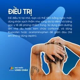 Viêm da do ánh nắng 6