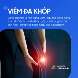 Viêm đa khớp 1