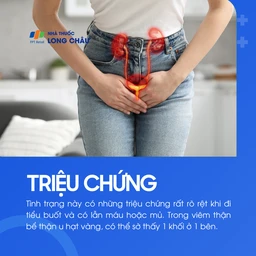 Viêm đài bể thận 2