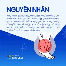 Viêm đầu xương gót 3
