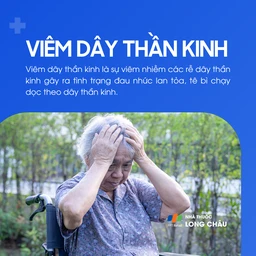 Viêm dây thần kinh 1