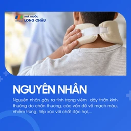 Viêm dây thần kinh 3