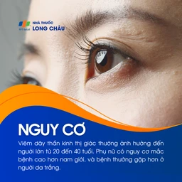 Viêm dây thần kinh thị giác 4