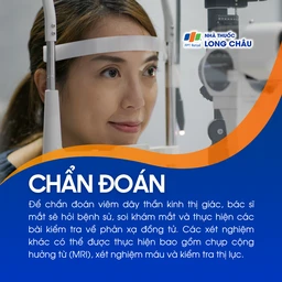 Viêm dây thần kinh thị giác 5