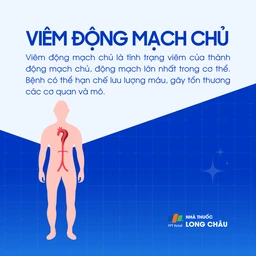 Viêm động mạch chủ 1