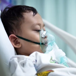 Viêm đường hô hấp trên ở trẻ em 3