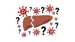 Viêm gan bí ẩn​ là gì? Triệu chứng, nguyên nhân, chẩn đoán, điều trị và phòng ngừa 1