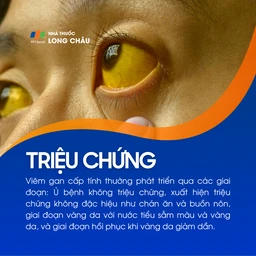 Viêm gan cấp tính 2