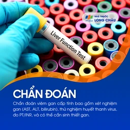 Viêm gan cấp tính 5