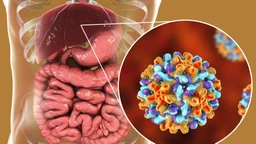 Tế bào hệ miễn dịch tấn công nhầm vào gan