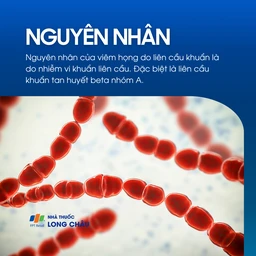 Viêm họng do liên cầu 3