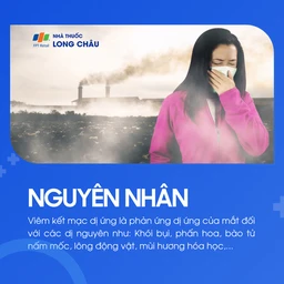 Viêm kết mạc dị ứng 3