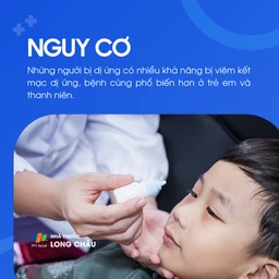 Viêm kết mạc dị ứng 4