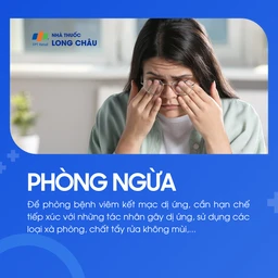 Viêm kết mạc dị ứng 7