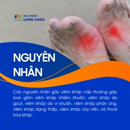 Viêm khớp cấp 3