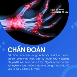 Viêm khớp cổ tay 5