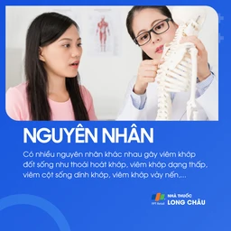 Viêm khớp đốt sống 3