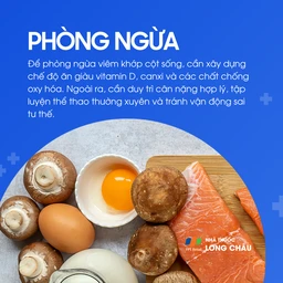 Viêm khớp đốt sống 7