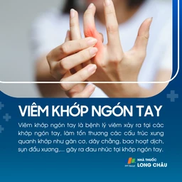 Viêm khớp ngón tay 1