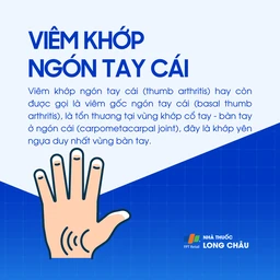 Viêm khớp ngón tay cái 1