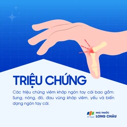 Viêm khớp ngón tay cái 2
