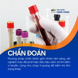 Viêm khớp phản ứng 5