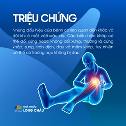 Viêm khớp thiếu niên 2