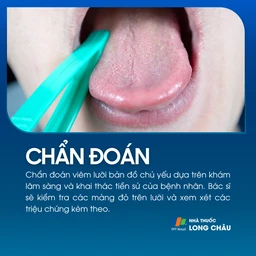 Viêm lưỡi bản đồ 5