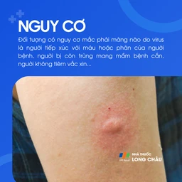 Viêm màng não do virus 4