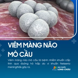 Viêm màng não mô cầu 1