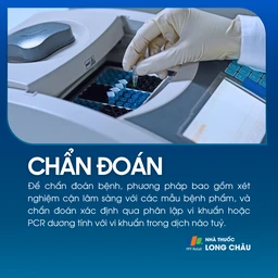 Viêm màng não mô cầu 5