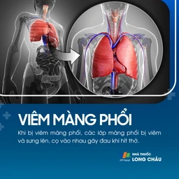 Viêm màng phổi 1