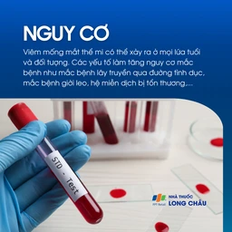 Viêm mống mắt thể mi 4